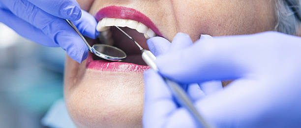 Best Emergency Wisdom Teeth Removal in Mooresville, IN